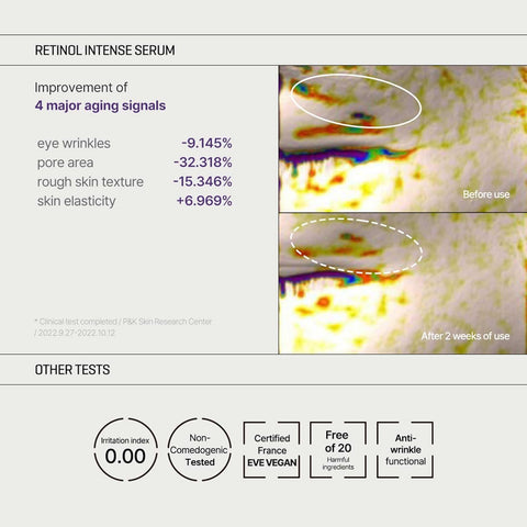 RETINOL INTENSE ADVANCED TRIPLE ACTION EYE CREAM 30ml