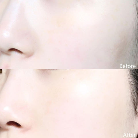BIFIDA BIOME AMPOULE TONER