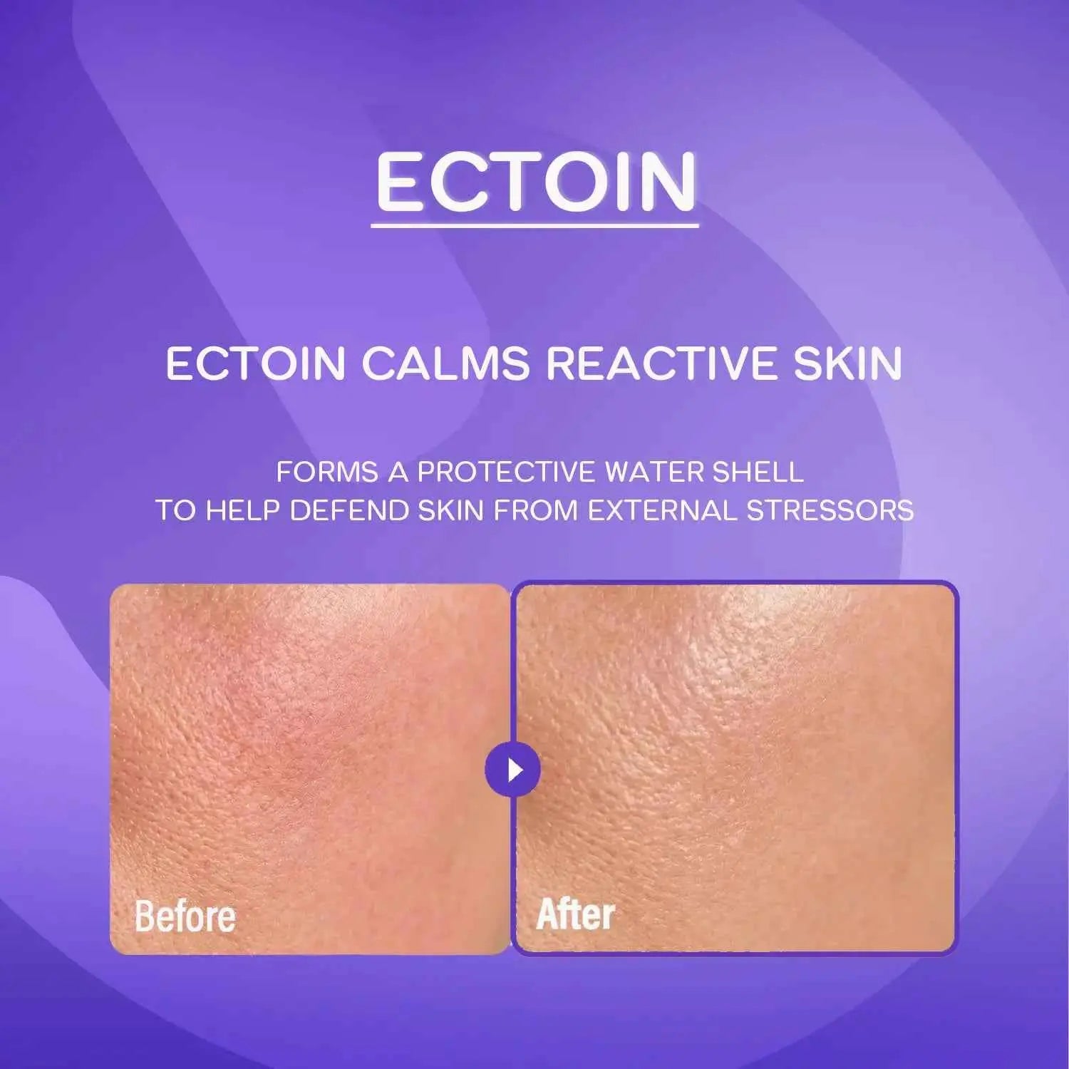 Epii Double Up Cream - Ectoin & Panthenol