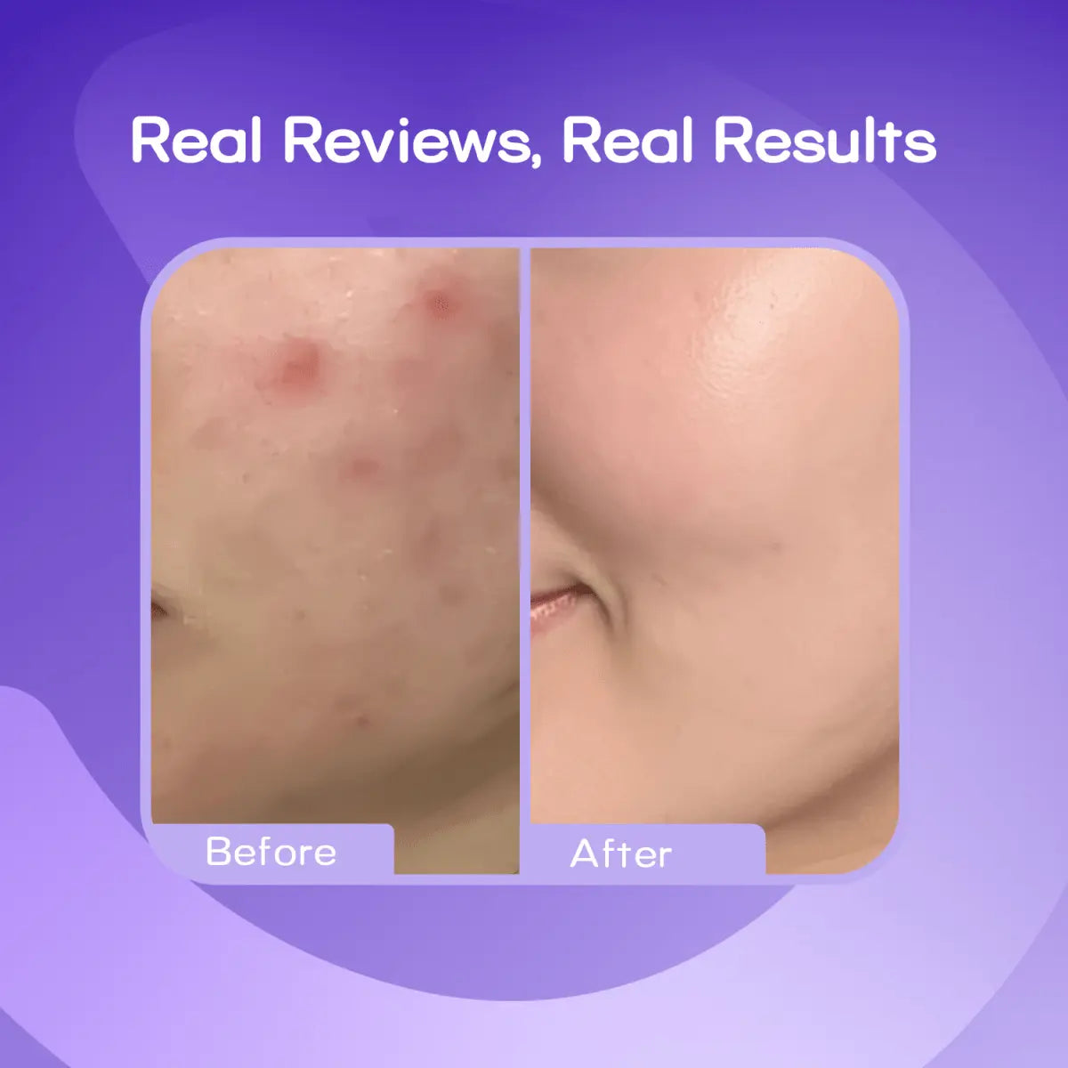Cosrx Salicylic Acid Daily Gentle CleanserCosrxMENA GLAM