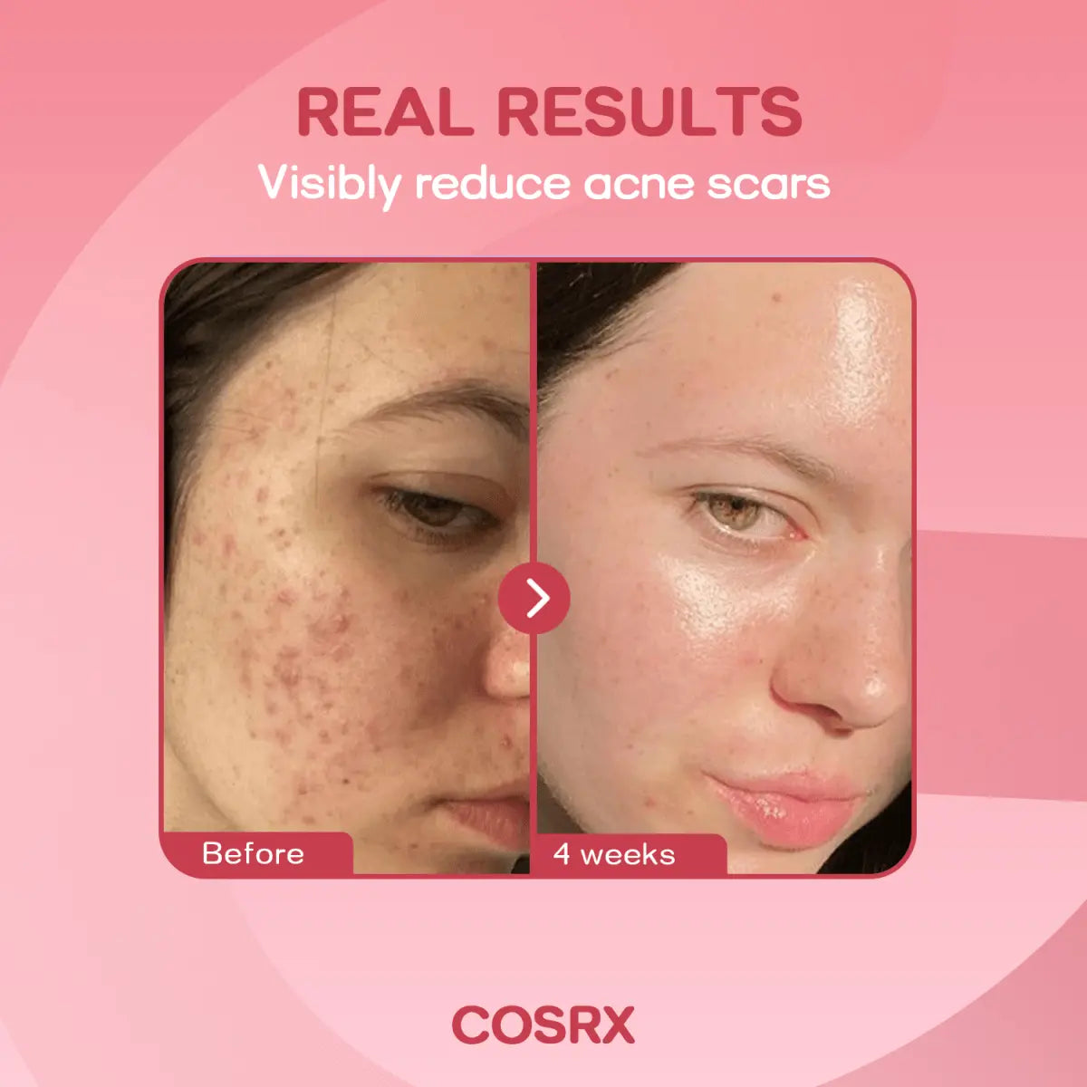 Cosrx The Niacinamide 15 SerumCosrxMENA GLAM