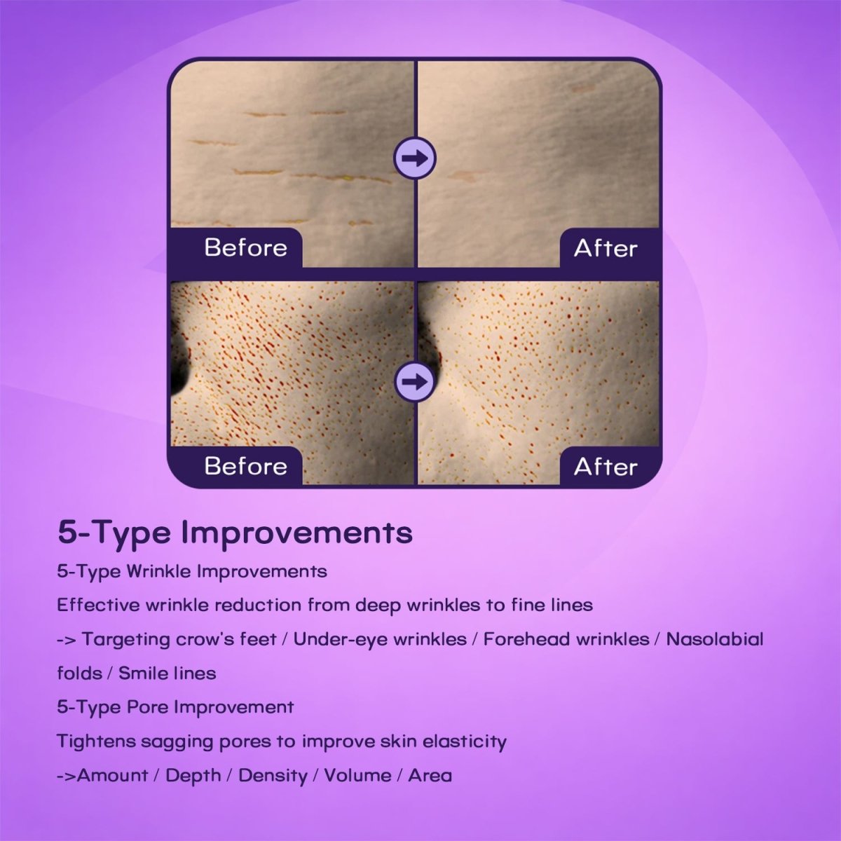 EQQUALBERRY - Bakuchiol Plumping Serum 30mlEQQUALBERRYMENA GLAM