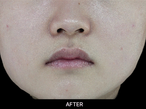 The Niacinamide 15 Serum