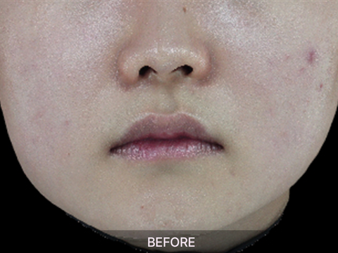 The Niacinamide 15 Serum