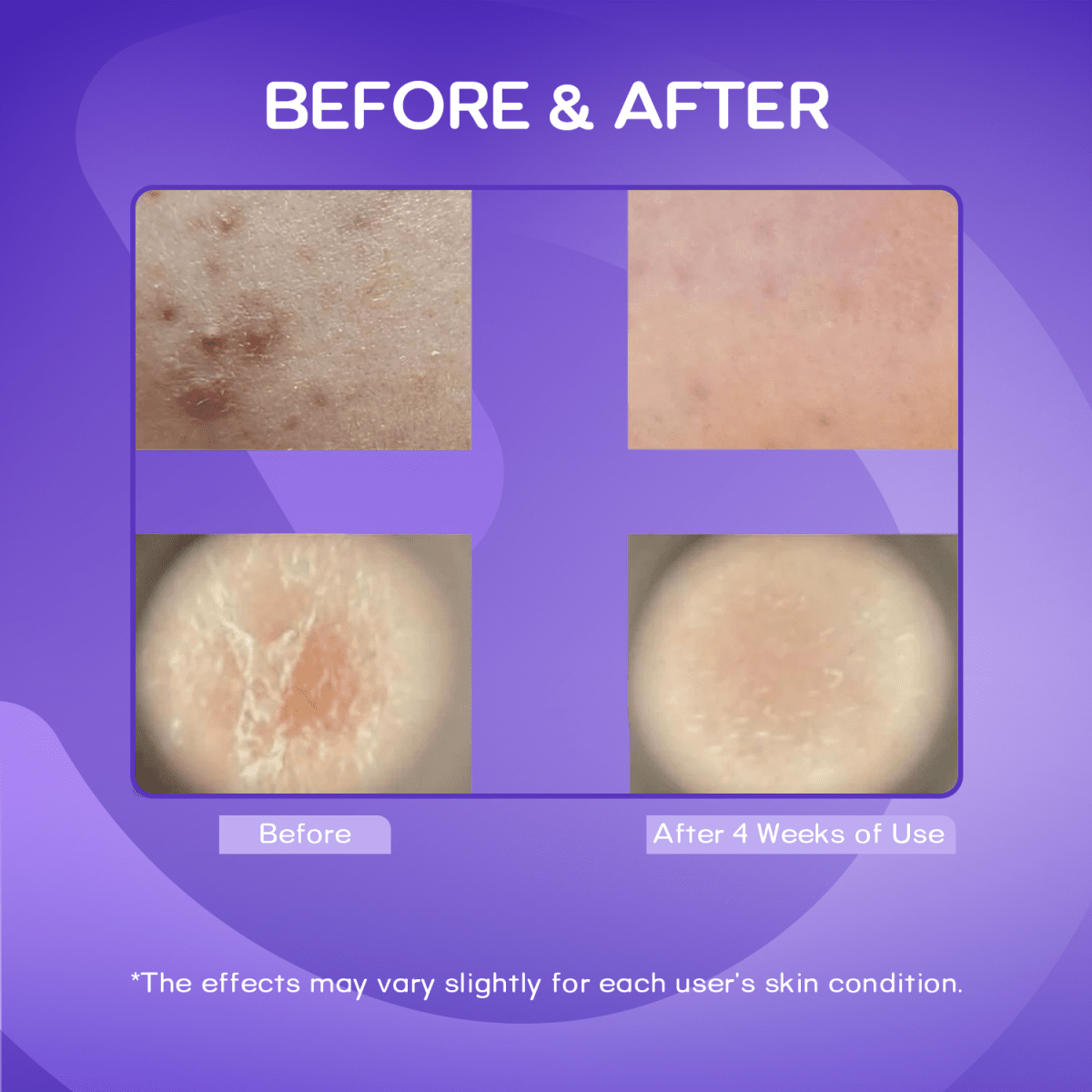 Vt Cosmatics Vt Reedle Shot 100 SerumVt CosmaticsMENA GLAM